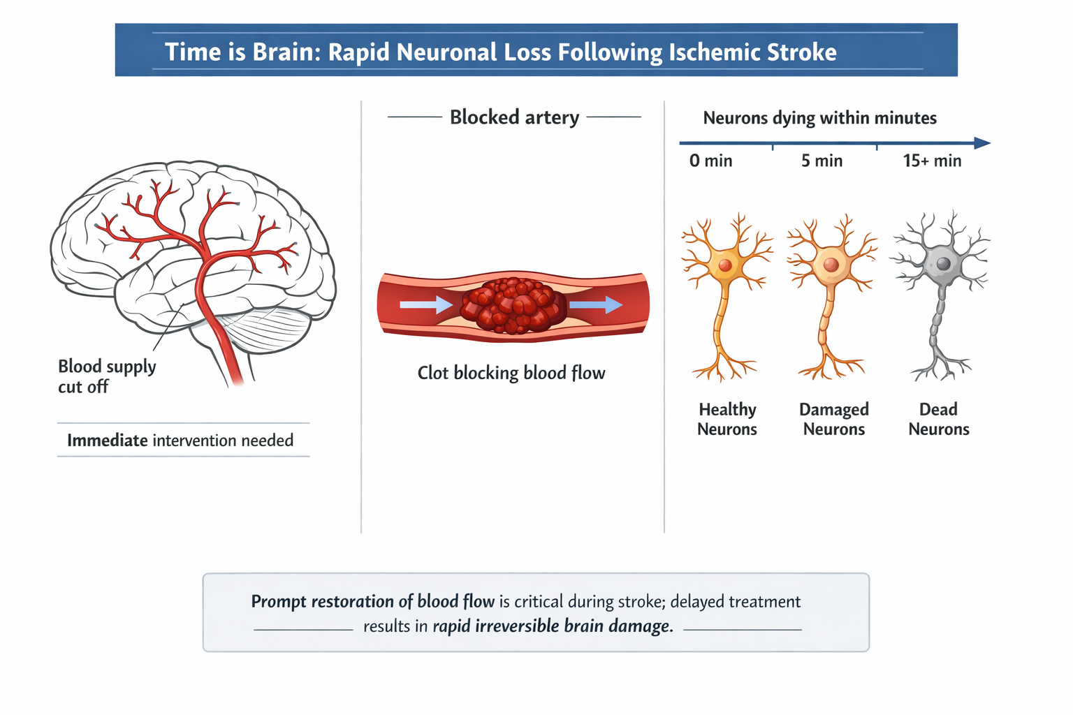 Neurological disorders expansion